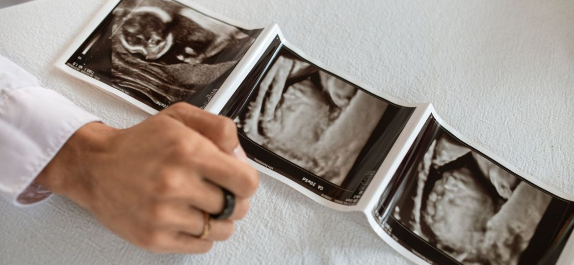 Fertilidade Podem A Cafe Na E O Lcool Afetar Os Tratamentos