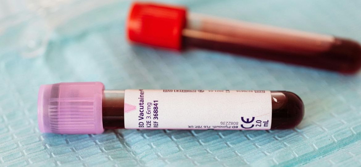 diagnosticar o cancro