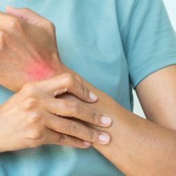 identificar a artrite psoriática