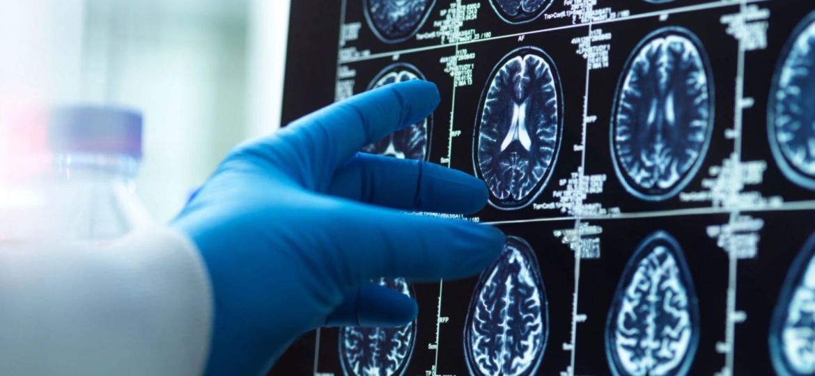 traumatismo cranioencefálico