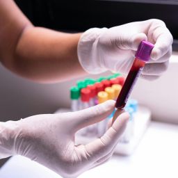 exame de sangue para detetar cancro