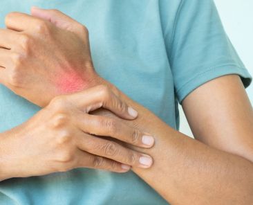 identificar a artrite psoriática