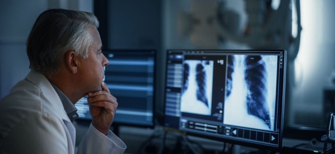 taxas de mortalidade por cancro do pulmão na UE