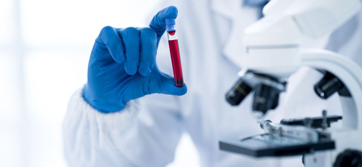 amostra de sangue para identificar infeções