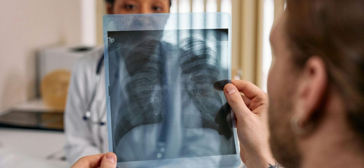 doenças pulmonares intersticiais