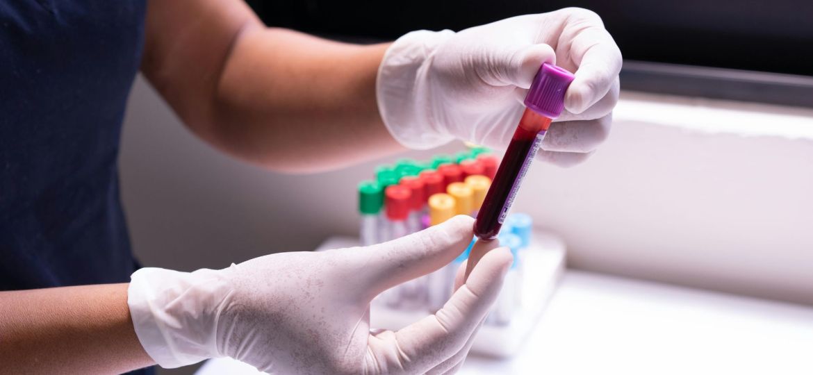 exame de sangue para detetar cancro