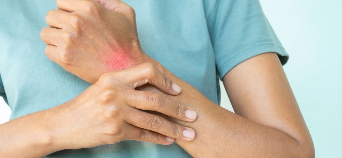 identificar a artrite psoriática