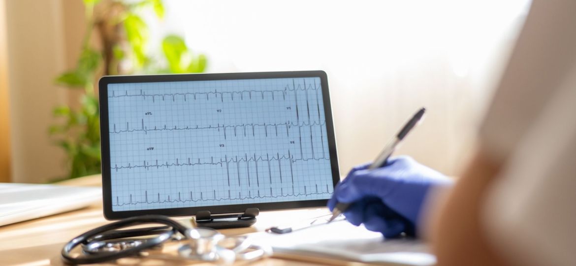 medir fibrilhação auricular