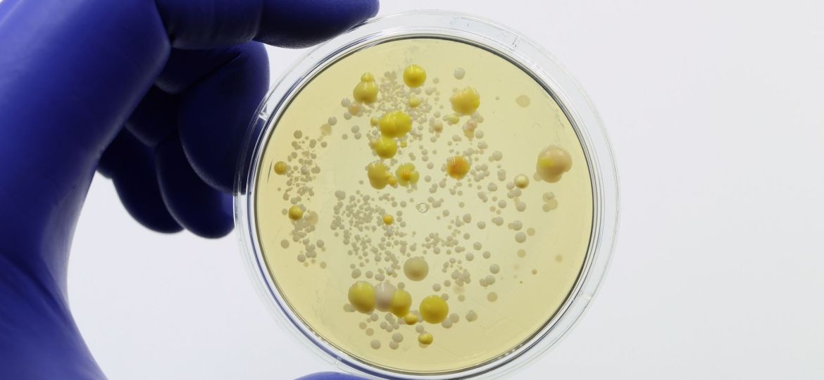 estudo sobre bactéria multirresistente