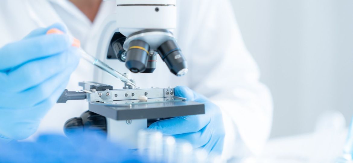 proteína controla o envelhecimento