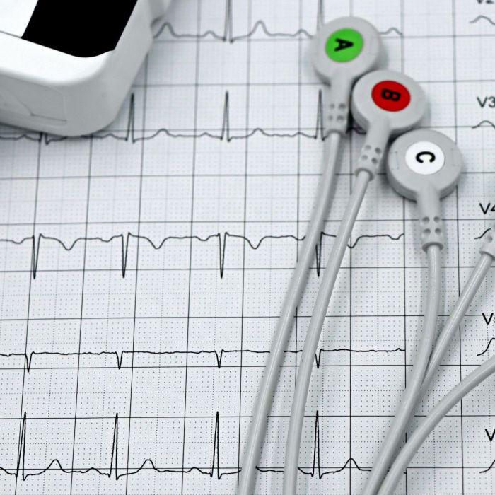 calor, frio e os eventos cardiovasculares