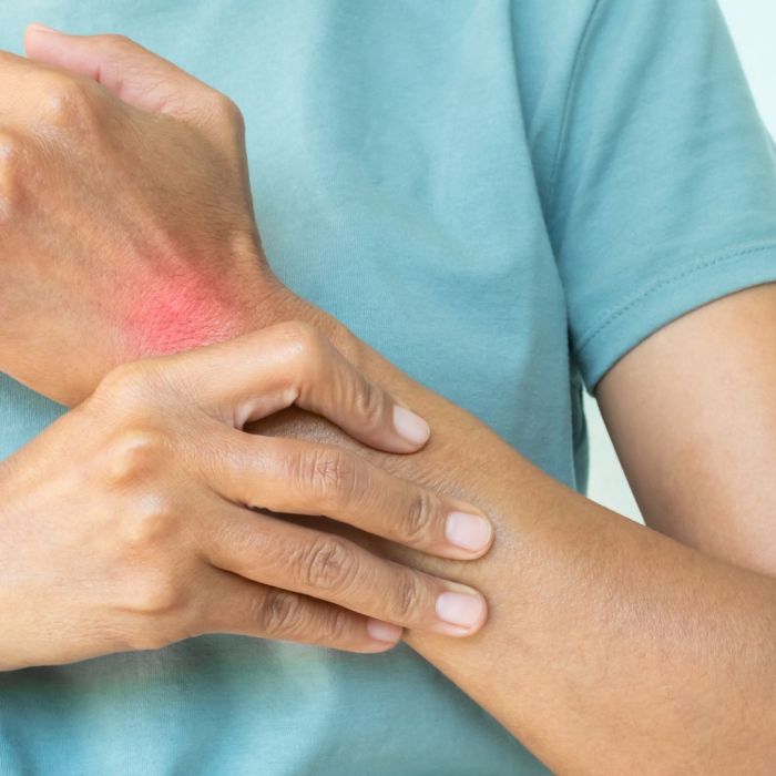 identificar a artrite psoriática