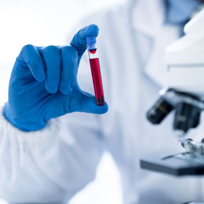 amostra de sangue para identificar infeções