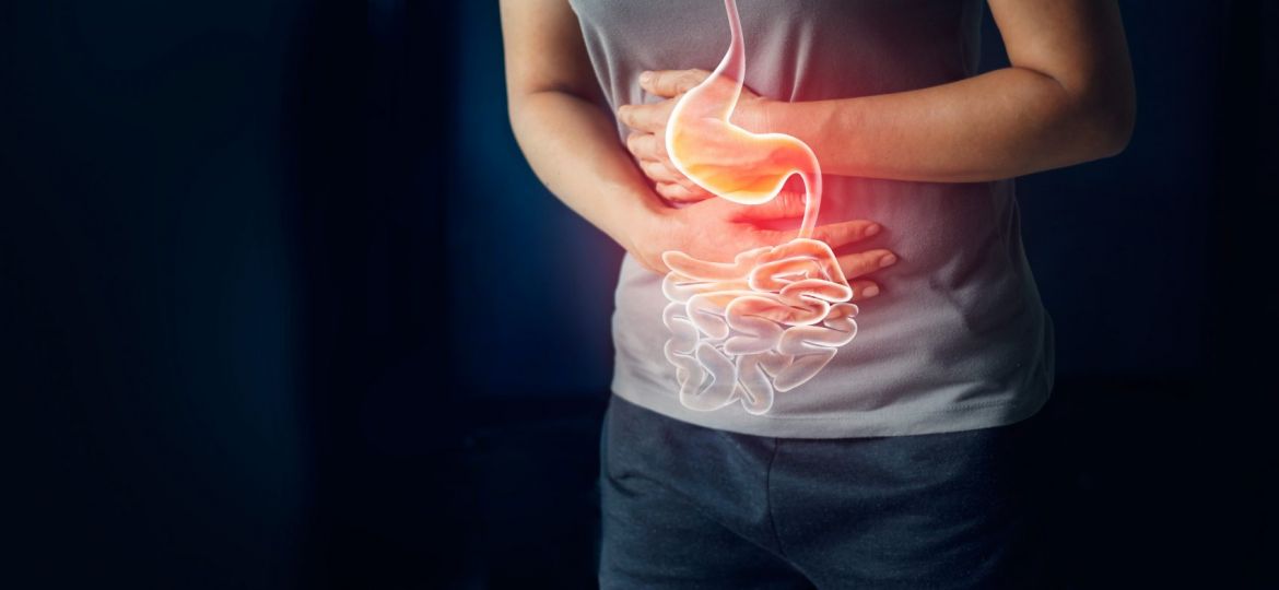 doença inflamatória intestinal e colite ulcerosa