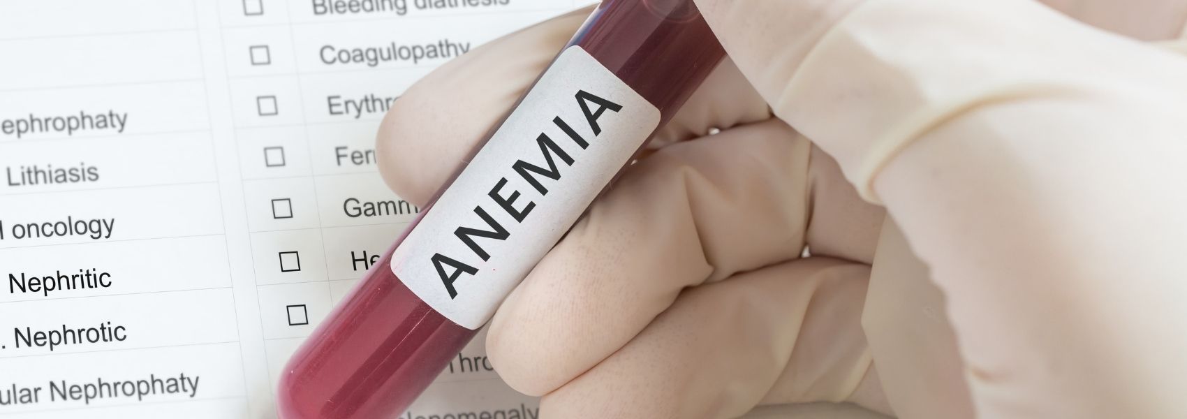 rastreios da anemia