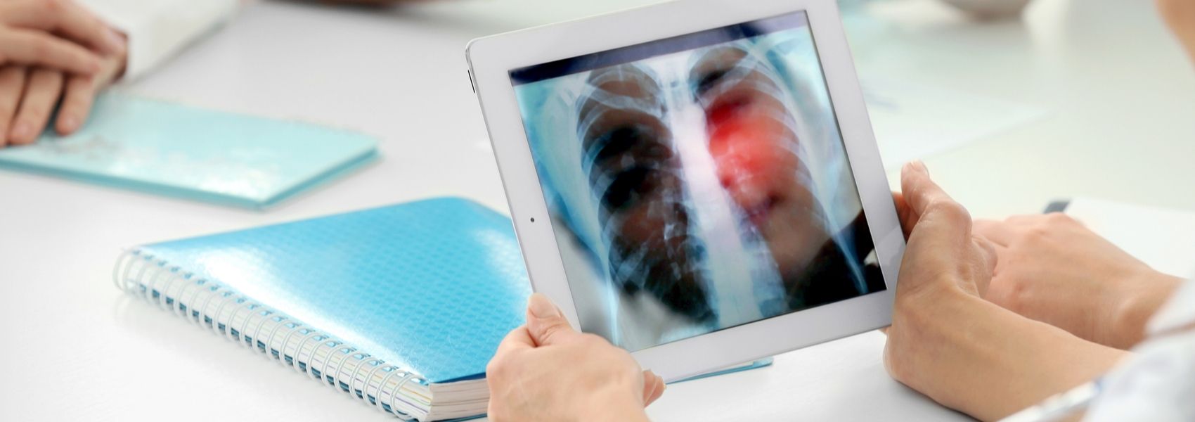 doenças intersticiais pulmonares