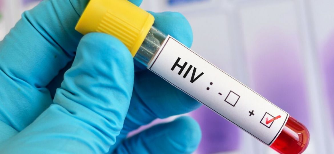 rastreios do VIH