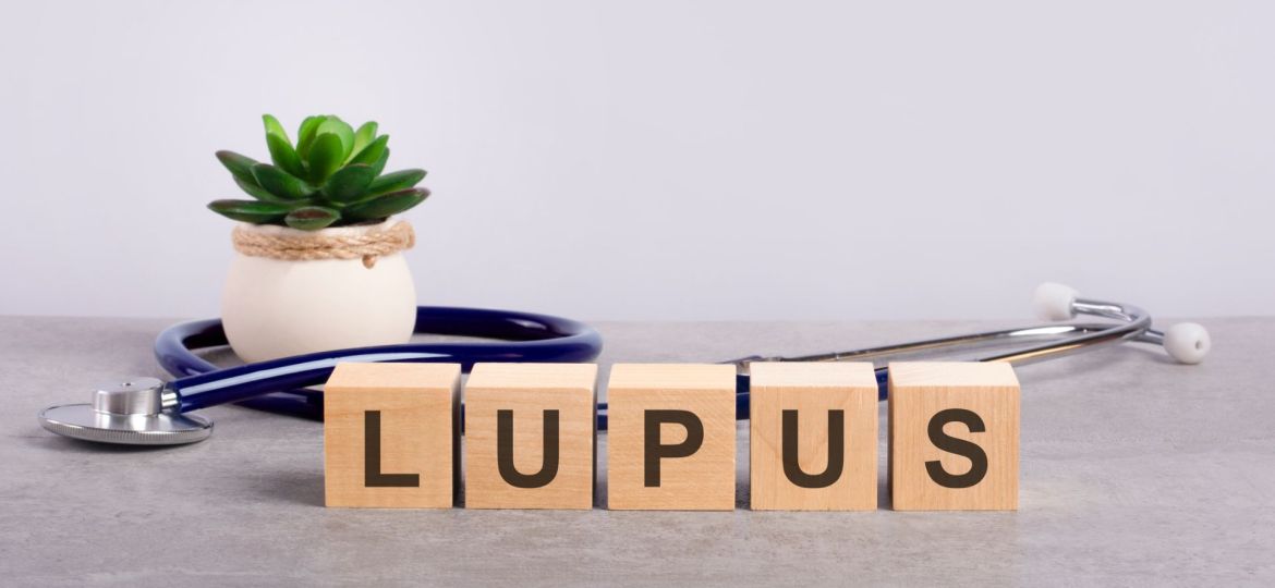 Lúpus