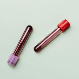 Teste de sangue para doenças raras