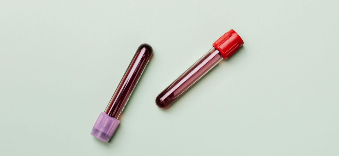 Teste de sangue para doenças raras