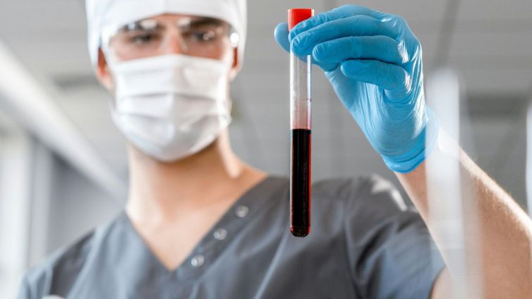 Biomarcadores para Alzheimer