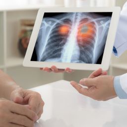 microplásticos causam danos nos pulmões
