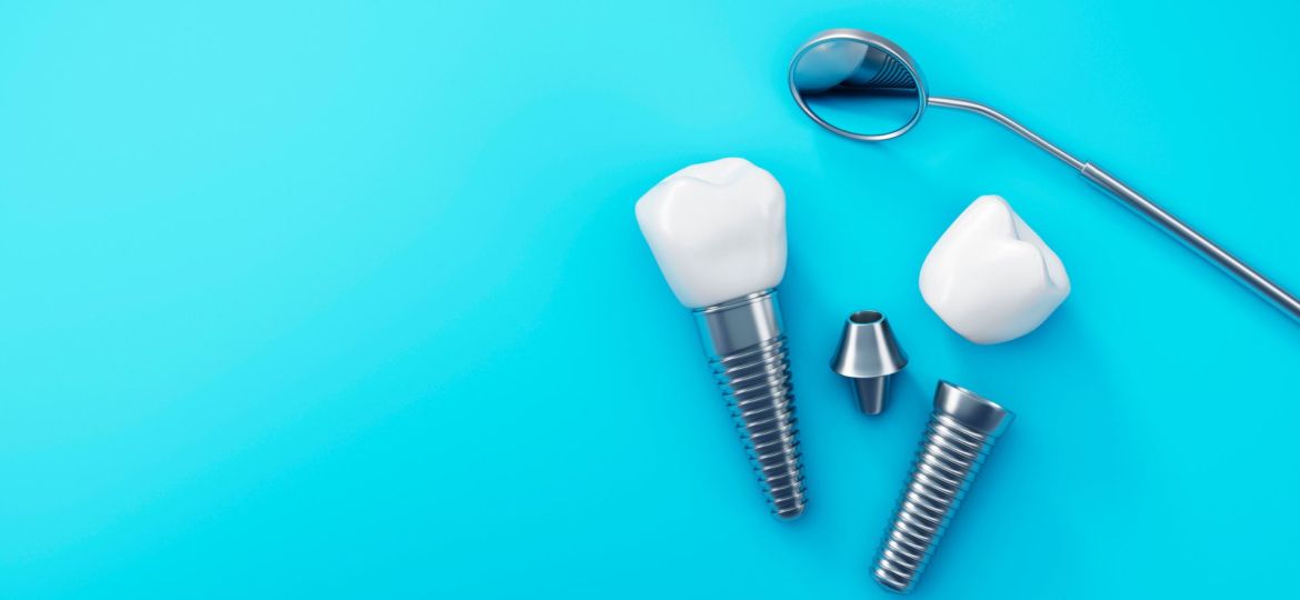 Implantes