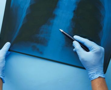 Doenças do Interstício Pulmonar