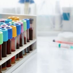 teste para diagnóstico de cancros