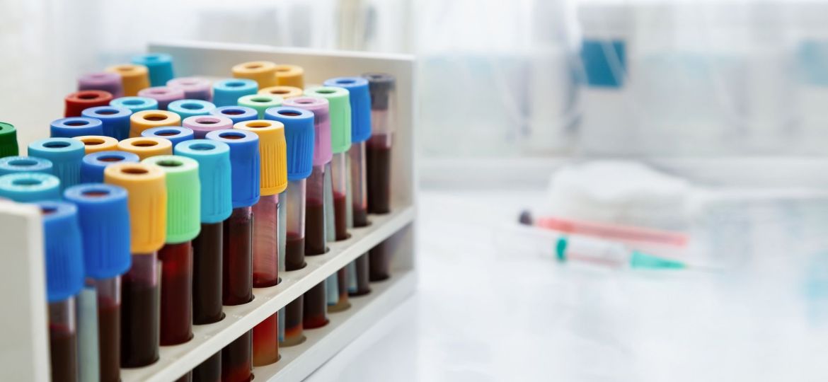 teste para diagnóstico de cancros