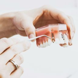 diabetes e saúde oral