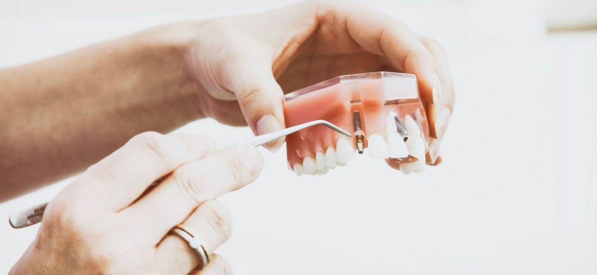 diabetes e saúde oral