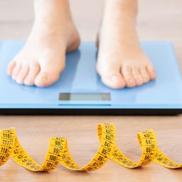 anorexia nervosa