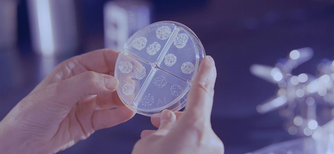 novo teste para diagnosticar tuberculose
