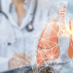 Doenças do Interstício Pulmonar